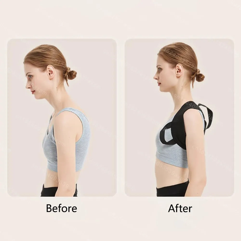 BackX™ - The ULTIMATE Back Posture Corrector -v.2